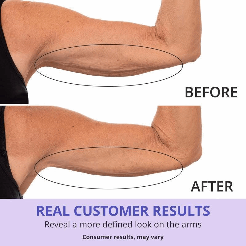 👉 Today only: 70% off your first order - Tighten & Smooth Belly Cream