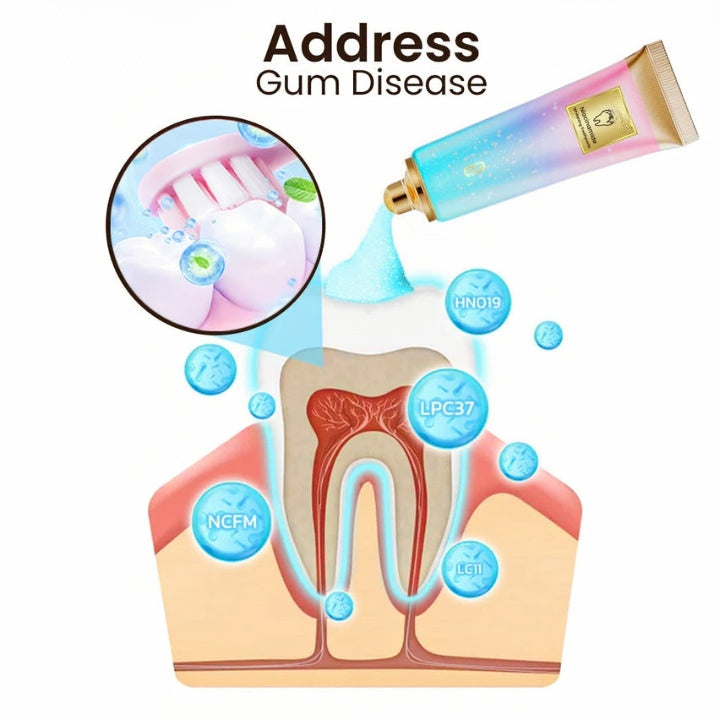 🔥Limited Stock –Niacinamide Whitening Toothpaste