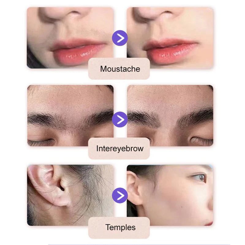 🔥 Buy 1 Get 1 FREE🔥Facial Hair Removal Cream
