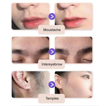 🔥 Buy 1 Get 1 FREE🔥Facial Hair Removal Cream